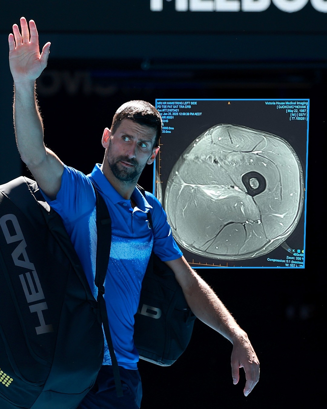 澳网力克拉沃尔杯,德约科维奇状态火热 澳网力克拉沃尔杯,德约科维奇状态火热